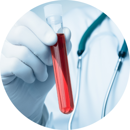 Prélèvements sanguins Prélèvements sanguins